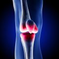 Articular cartilage – structure, biomechanics and damage aetiology